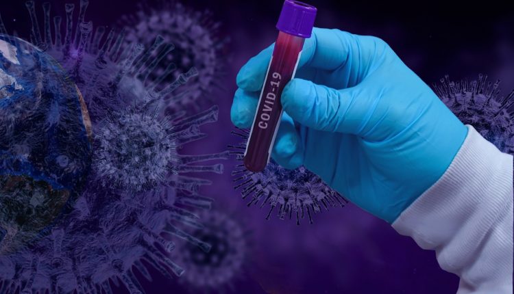 covid-19, coronavirus, epidemic